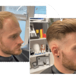 hair replacement for men near me