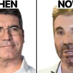 After Care Plastic Surgery Nurse