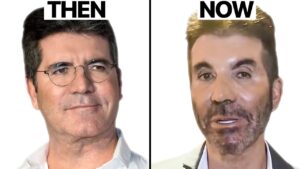 After Care Plastic Surgery Nurse