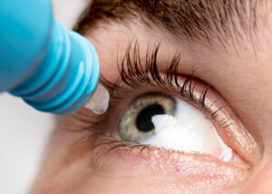 Affordable and Effective Dry Eye Treatment in India with Centurian Life Sciences