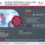 Global Non-Small Cell Lung Cancer Market Research Report Forecast (2022-2027)