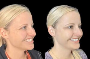 Smooth Skin Awaits at the Best Aesthetic Clinics in Dubai for Botox