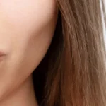 sculptra in dubai