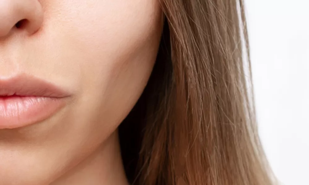 sculptra in dubai
