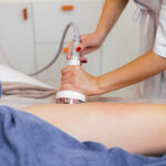 med spa cellulite treatment