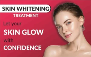 Skin Whitening Treatment