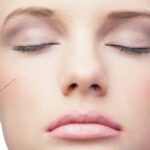 Cheek Fillers in Dubai