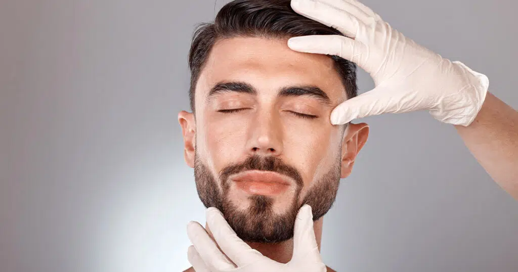 Buccal Fat Removal in Dubai
