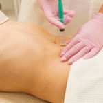 Fat Melting Injections in Dubai