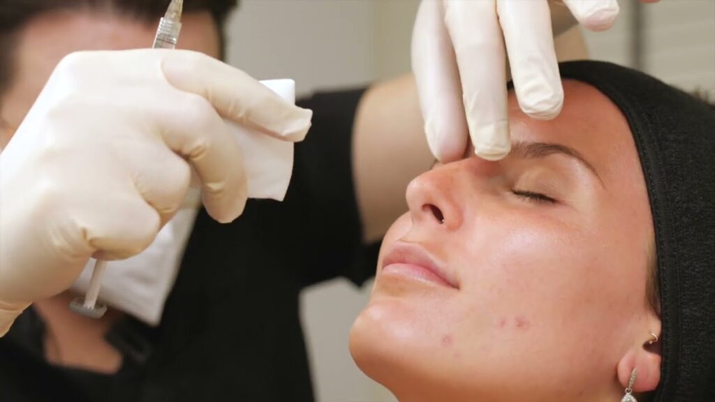 Nose Fillers in Dubai