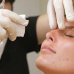 Nose Fillers in Dubai