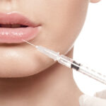 Lip Fillers in Dubai