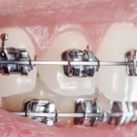 Orthodontist