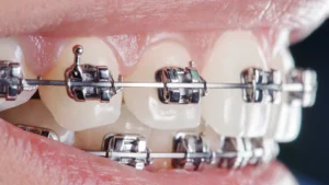 Orthodontist