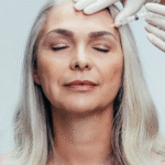 Belotero Fillers in Dubai