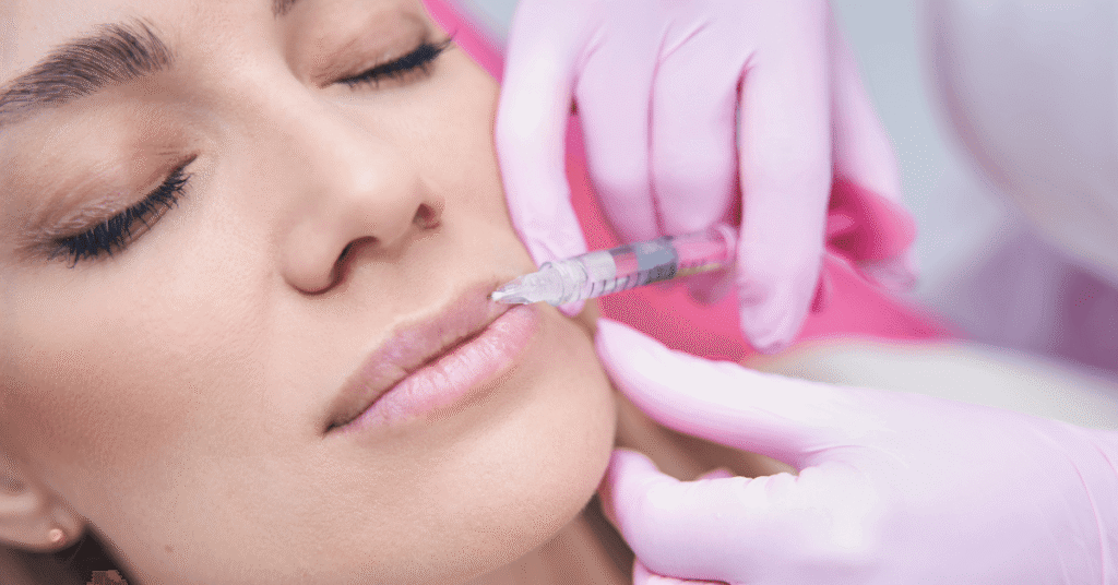 Lip Fillers in Dubai