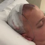 Brain Injury Recovery