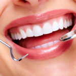 Dental Tooth Filling Dubai