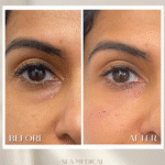 Polynucleotides Under Eyes In Manchester