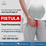 Fistula2
