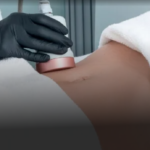 Vasser Liposuction In Dubai