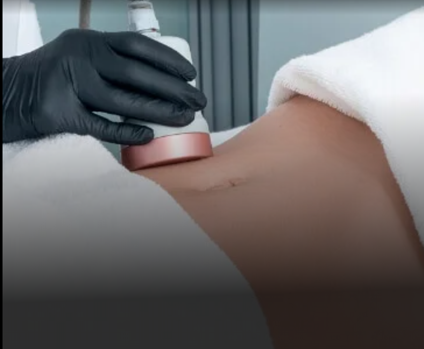 Vasser Liposuction In Dubai