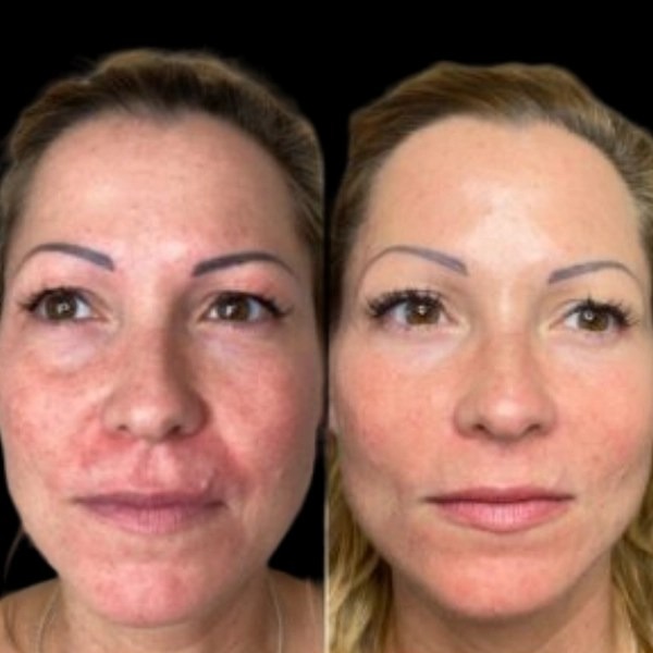 Best Plastic Surgeons in dubai