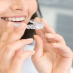 Invisalign Dubai