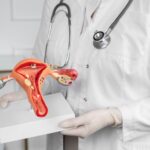 PAP_smear_30a37390ec