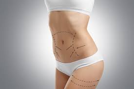 Fat Transfer in Dubai