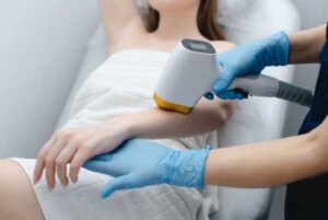 Laser Hair Removal