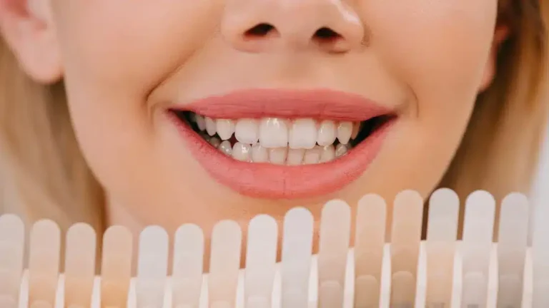 veneers-cosmetics-dubai