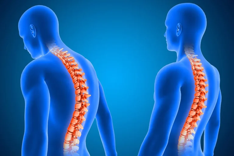 Spine Problem