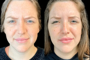 Best Plastic Surgeons in Dubai for Wrinkle Reduction