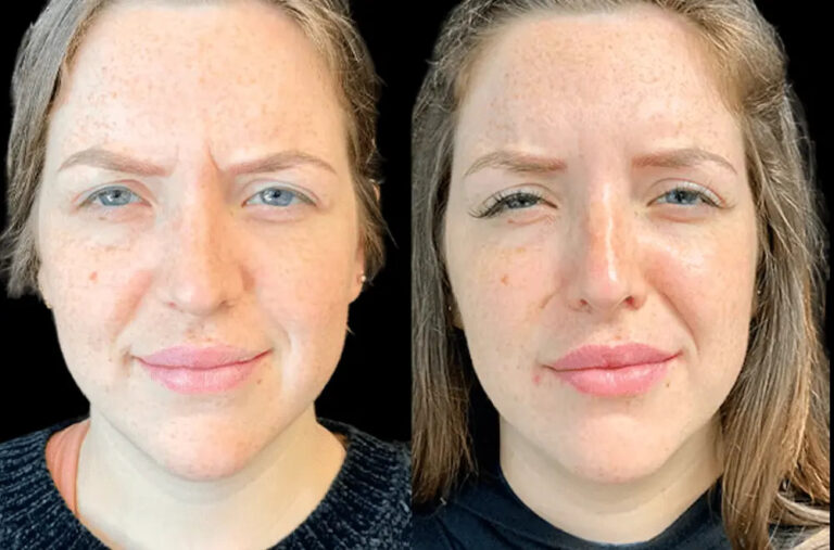 Comparing Clinics: Where the Best Doctors in Dubai Perform Botox