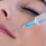 Botox Injections in Dubai