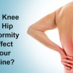 Can Knee or Hip Deformity Affect Your Spine