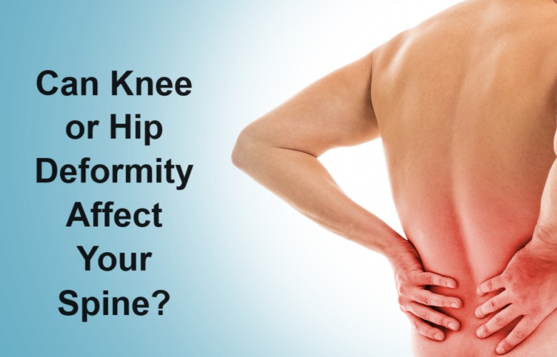 Can Knee or Hip Deformity Affect Your Spine