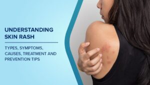 Mild Inflammation in Sensitive Body Areas for Managing Home Care Tips