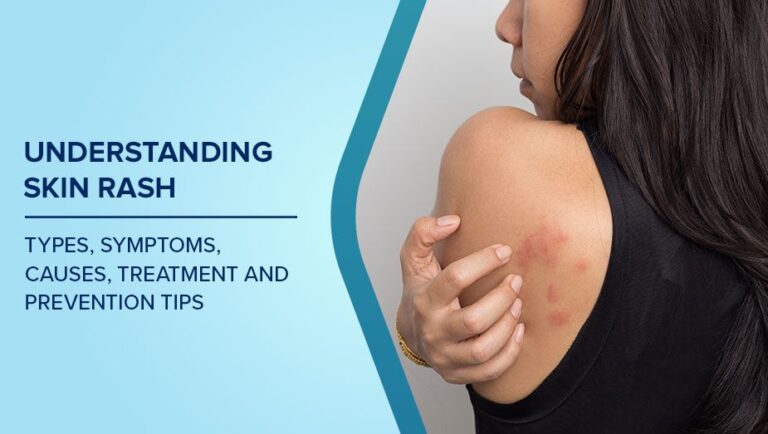 Mild Inflammation in Sensitive Body Areas for Managing Home Care Tips