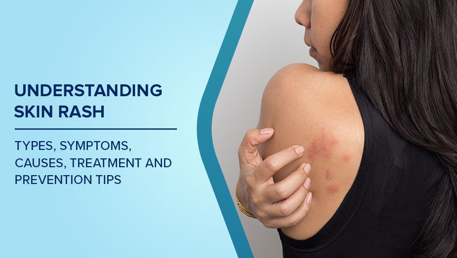 Mild Inflammation in Sensitive Body Areas for Managing Home Care Tips