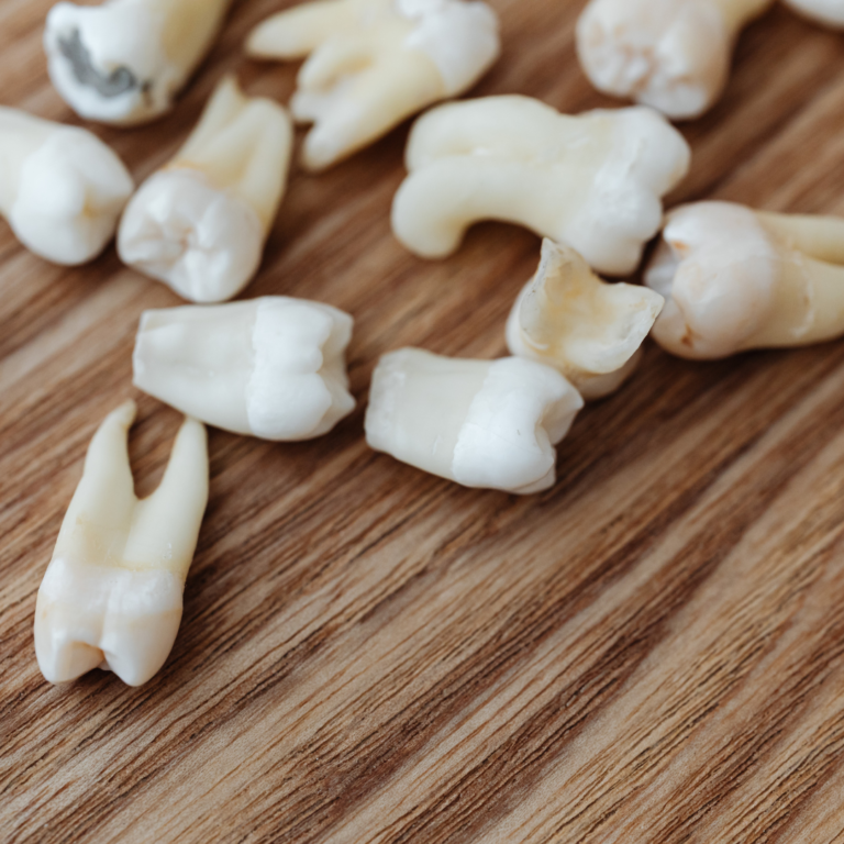 Wisdom Teeth Removal nj