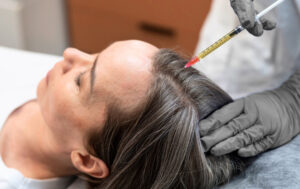 exosome therapy for skin rejuvenation​ , Delray Beach