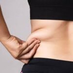 liposuction in dubai