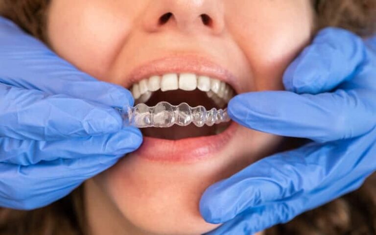 invisalign fort lauderdale