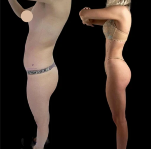 J-Plasma Treatment in Dubai