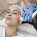 How Does Laser Acne Scar Removal Improve Skin Texture and Tone?