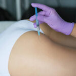 Are Butt Fillers Worth Trying for Shape