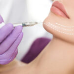 Are Jawline Filler Injections Quick Procedure