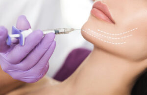 Are Jawline Filler Injections Quick Procedure
